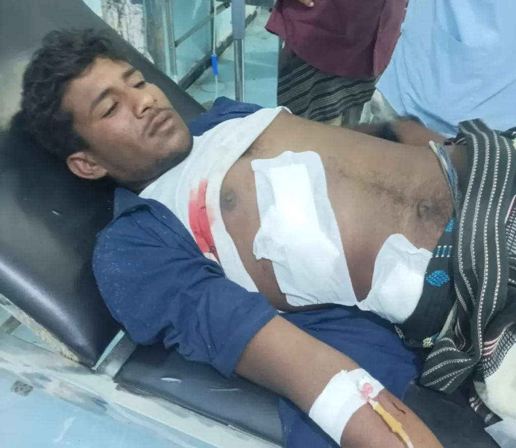 إصابة مواطن بقصف حوثي استهدف مخيماً للنازحين جنوب الحديدة