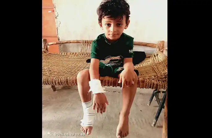 Un enfant blessé par des éclats lors d'une attaque de drone des milices houthis sur un village résidentiel à Hays.