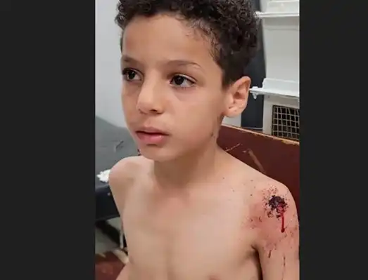 A child was killed, and a woman along with four children were injured in a missile explosion and Houthi shelling in Marib, Al-Dhale, and Taiz.