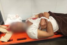 مركز حقوقي: 154 قتيلاً وجريحاً بنيران الحوثيين في تعز منذ مطلع أكتوبر