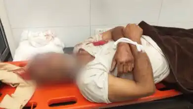 مركز حقوقي: 154 قتيلاً وجريحاً بنيران الحوثيين في تعز منذ مطلع أكتوبر