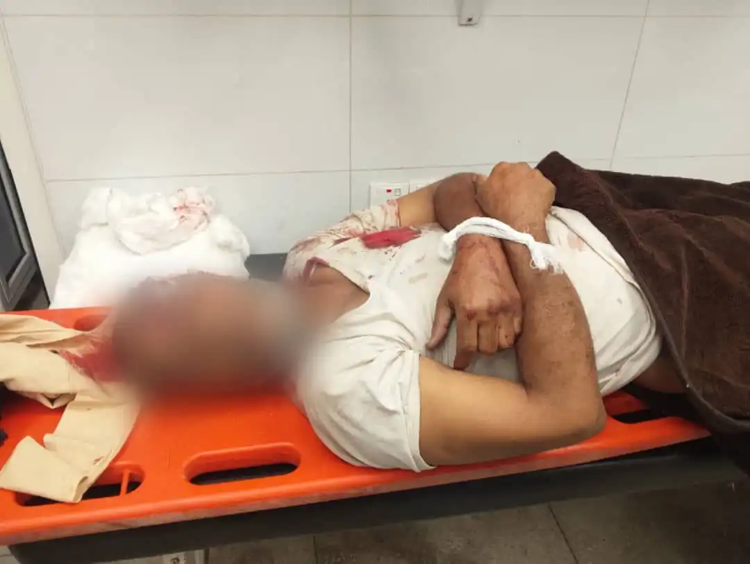 A rights center reports 154 killed and injured by Houthi fire in Taiz since the beginning of October.